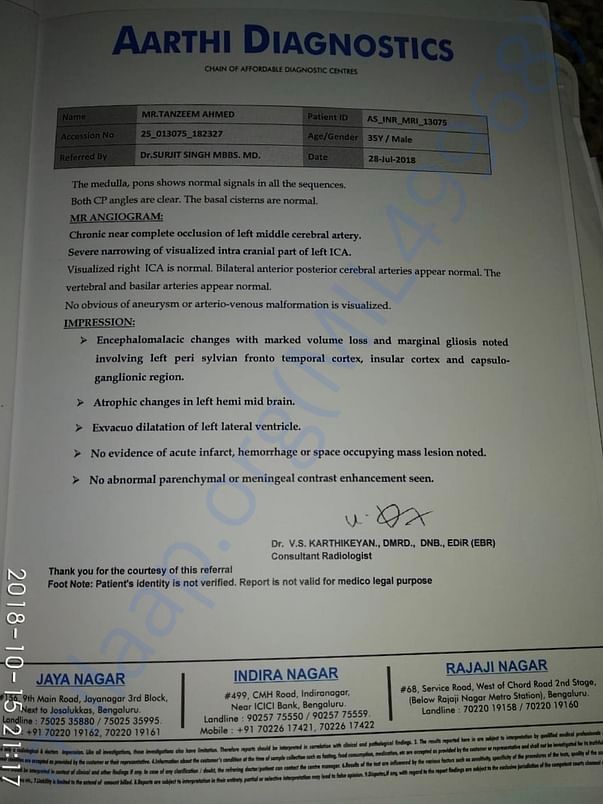Latest MRI scan 2