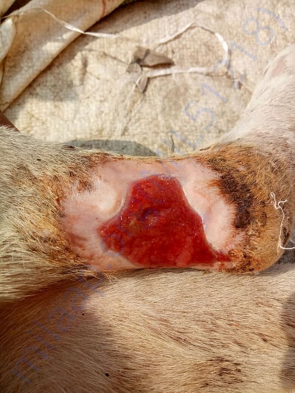 Treatment of burn wound