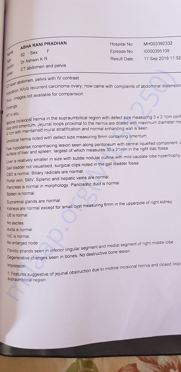 Ct scan