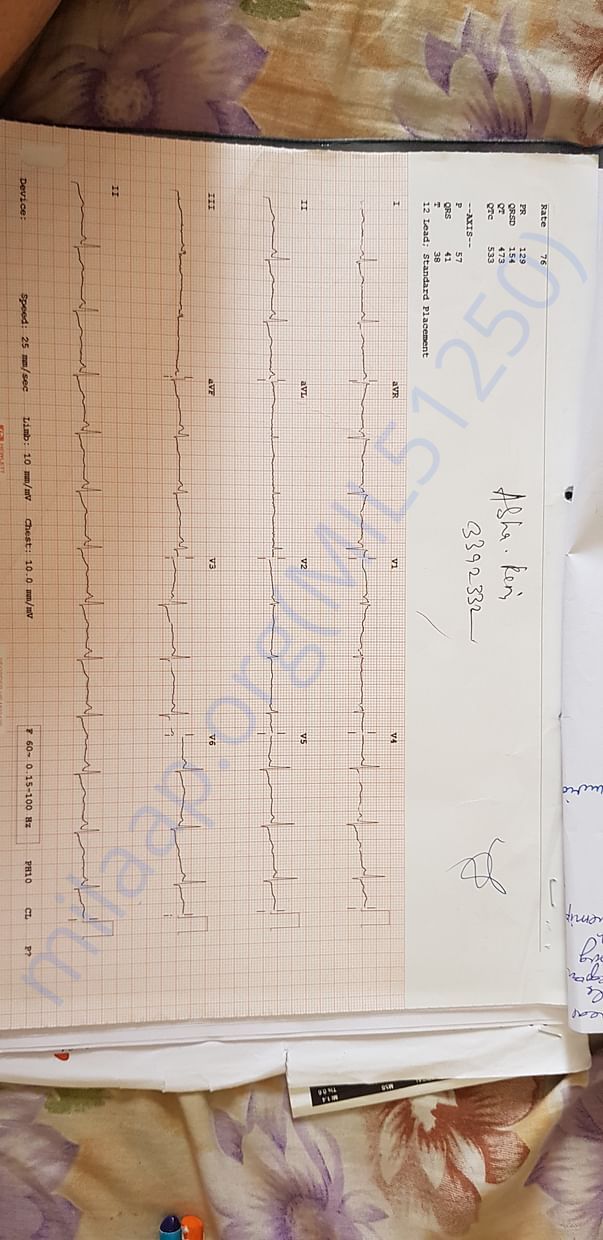 ECG