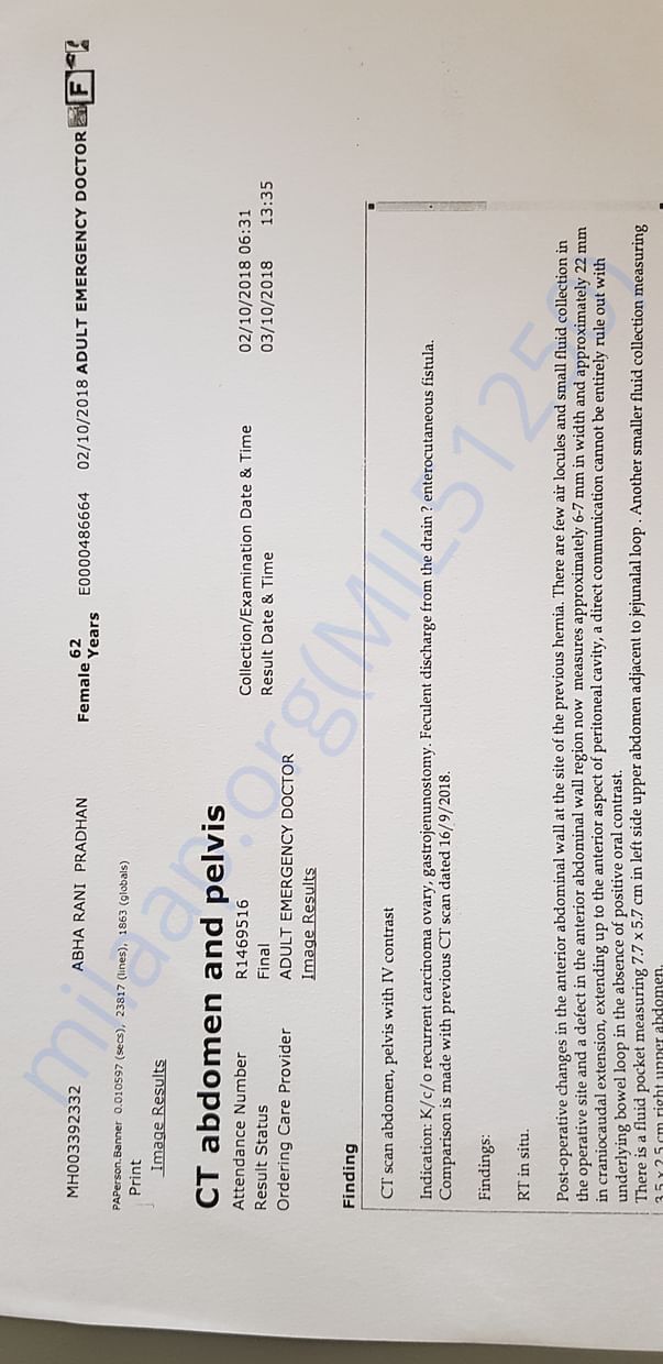 Ct scan 2nd Oct