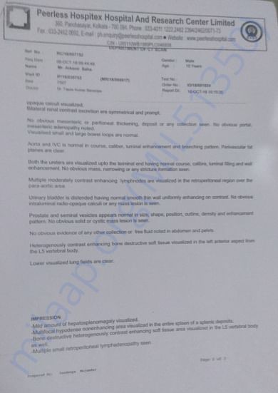 CT Scan 2
