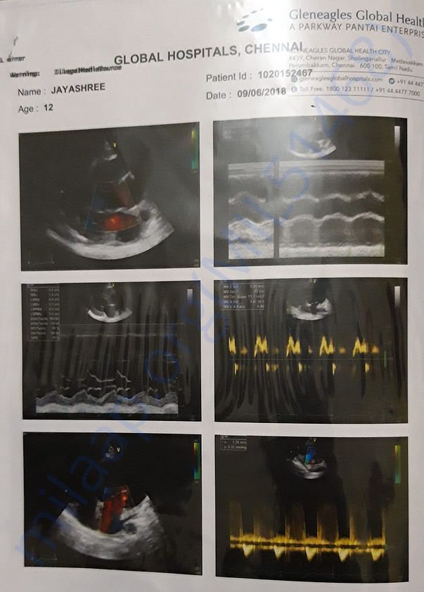 SCAN REPORT