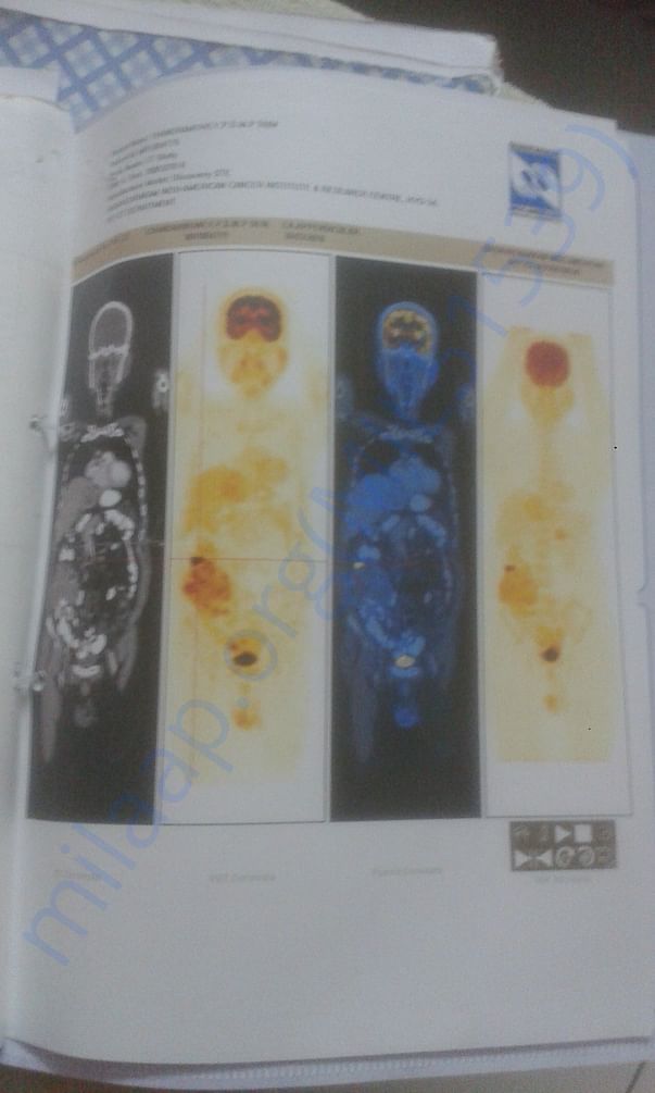 scanning files