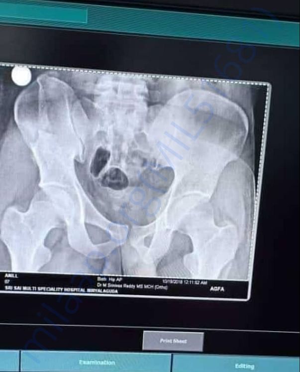 Xray