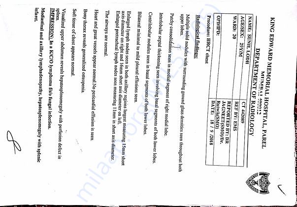 CT scan report