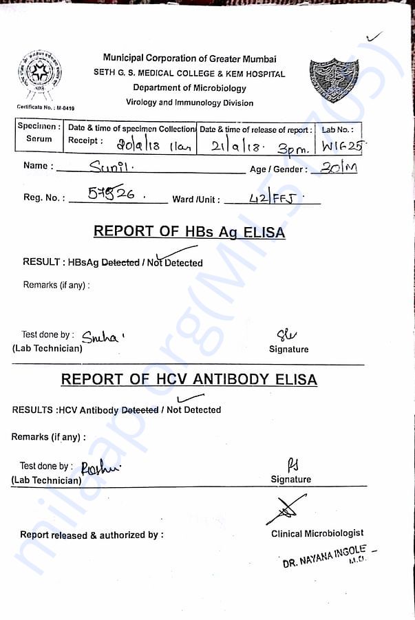Report of HBC and HCV elisa