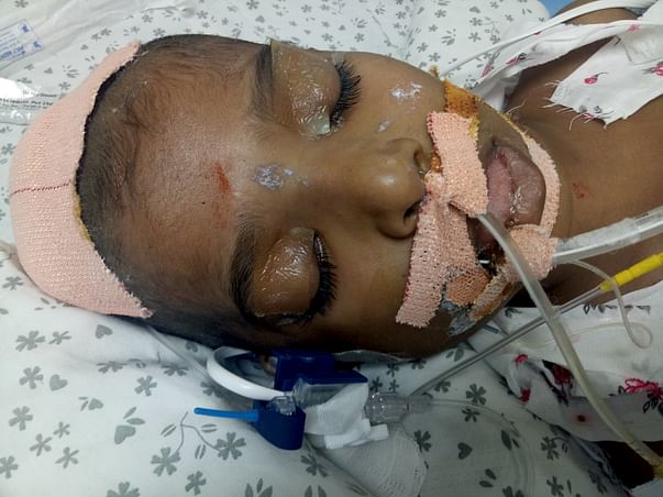 Help Ram Recover From A Critical Brain Disease