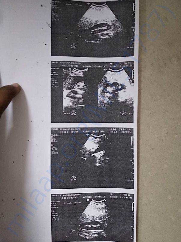 Ultrasound scan