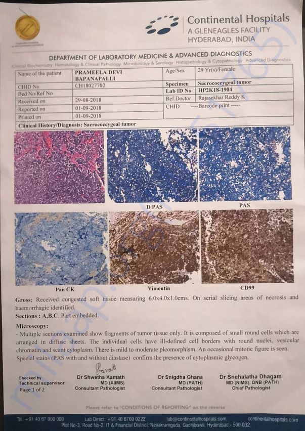 Biopsy