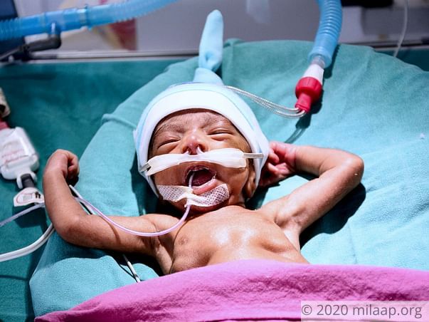 Within Seconds Of His Birth, This Baby Was Fighting For His Life