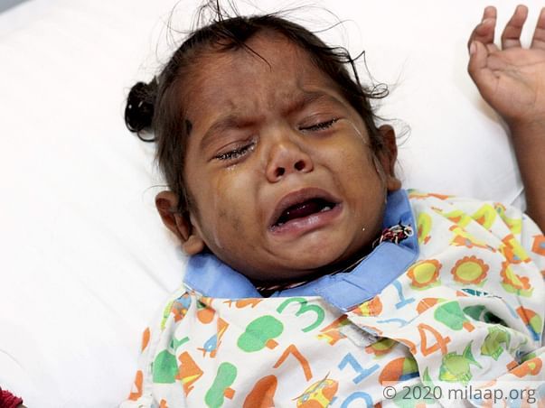 Every Breath Is A Struggle For This Baby Who Needs Open Heart Surgery