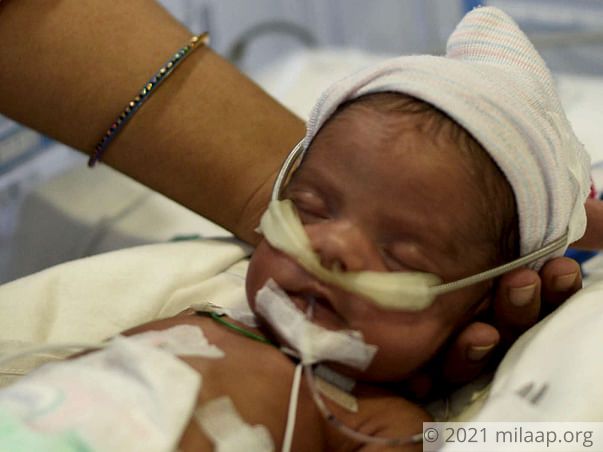 15 days old baby of Shilpi needs your help to survive