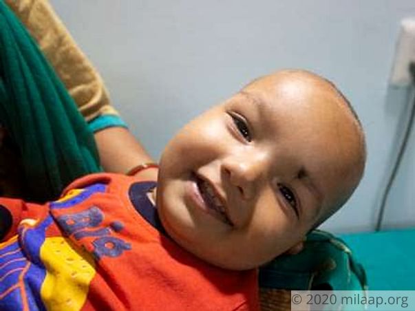 9-Month-Old Whose Breathlessness Doesn't Let Him Sleep Beyond 15 Mins