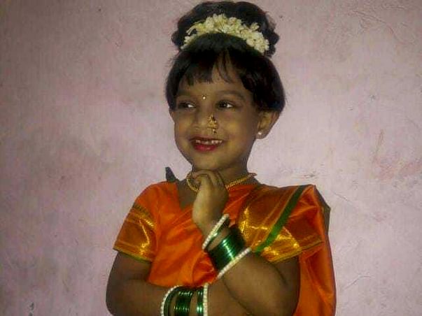 Help 5 year old Yukti - Chronic Kidney disease