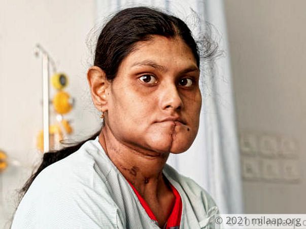 Paramita needs your support to undergo her treatment