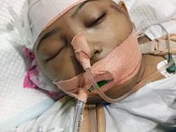 Help Us Save Swati Recover From Severe Injuries