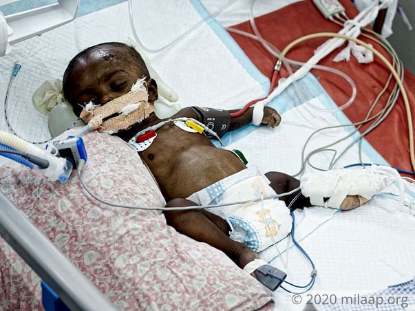 Despite Being On Ventilator, This Baby Boy Will Die Without Help Now