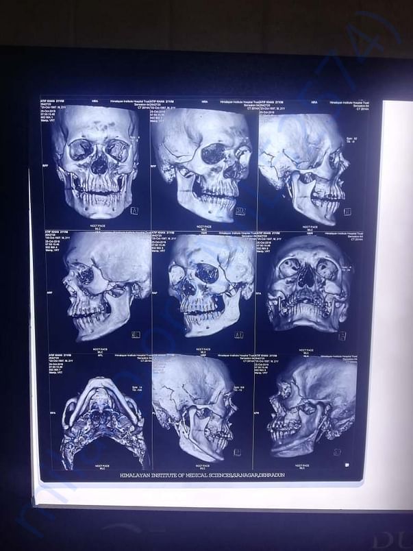 X-ray