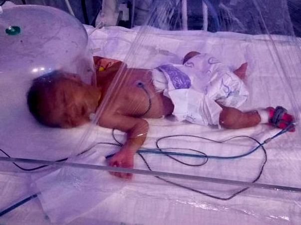 Save My 8-days-Old Premature Baby With Underdeveloped Organs