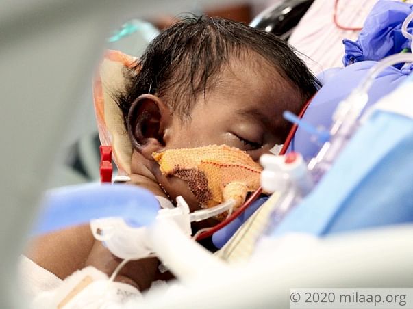 Support Muvikaran to fight cardiac disease