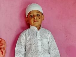 Help Our Little Ayan Undergo Bone Marrow Transplant