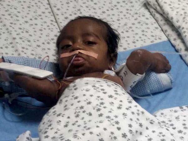 Help Baby SaiChand Recover
