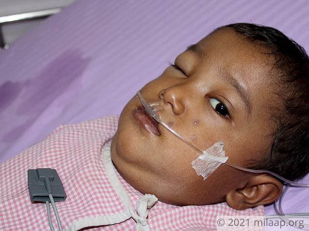 3-Year-Old Will Suffocate To Death If His Chest Tumor Is Not Removed