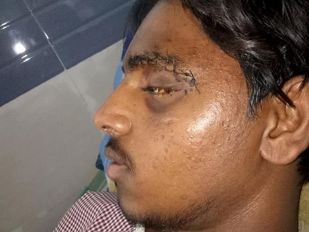 Help My Brother Recover From A Major Accident