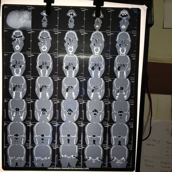 xray1
