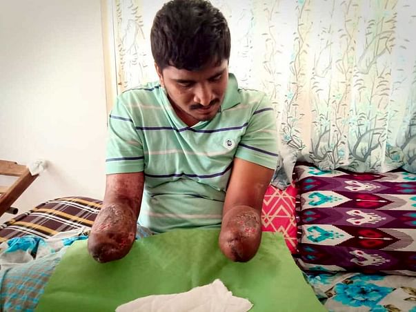 Help Vivek Get Back At Life!