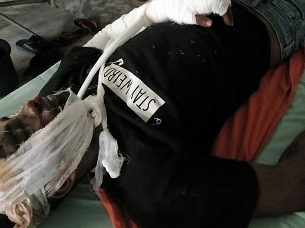 Help Sai To Fight Accident