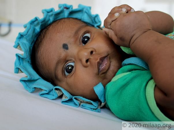 Only An Open Heart Surgery Will Save This 4-Month-Old's Life