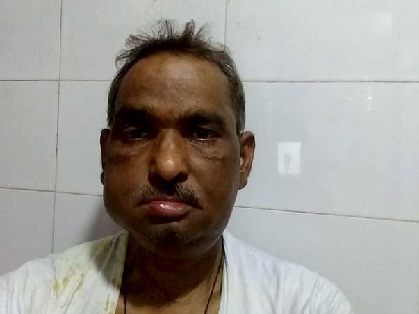 Help My Father Fight Cancer