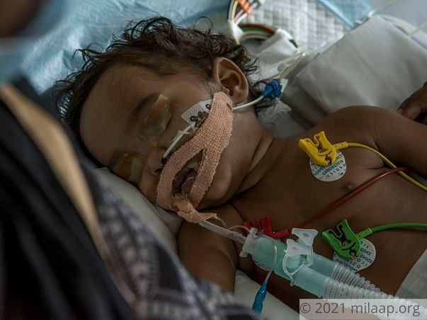 Daily Wager's Only Daughter Struggles To Breathe, Needs Urgent Help