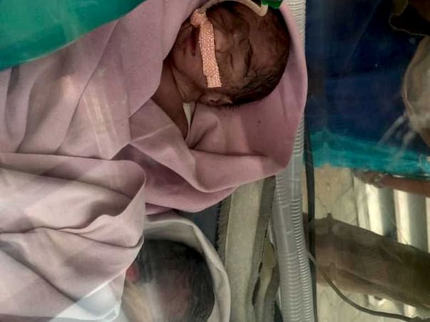Help My Brother's Twin Babies Suffering LBW