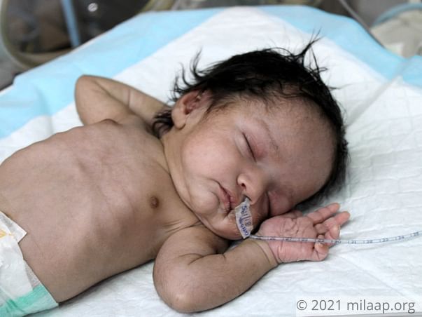 Mother Struggles To Save Baby Girl From A Rare And Deadly Disease