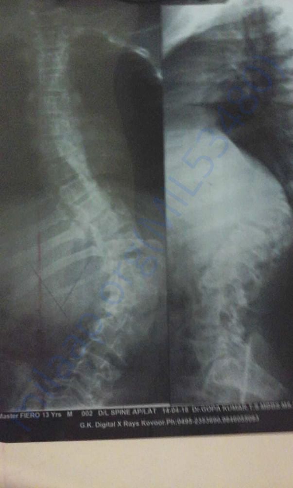 X ray report