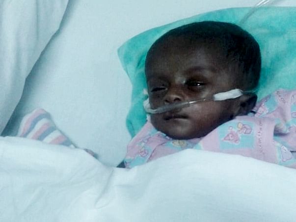 Help Little Saayishri Undergo Open Heart Surgery
