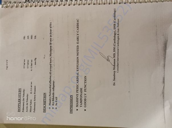 Document 2