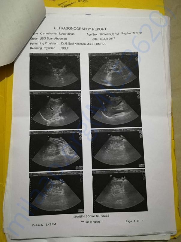 Sonogram report