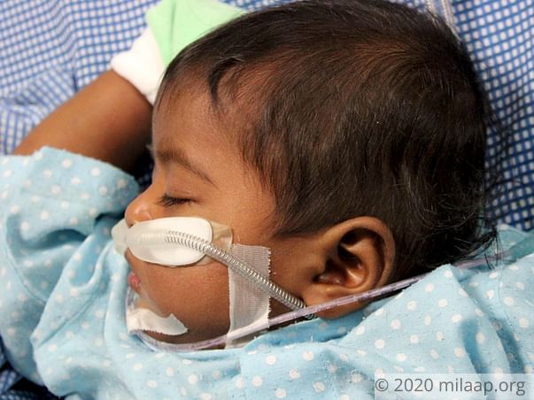 6-Month-Old Baby's Liver And Lungs Are Severely Infected, Needs Help