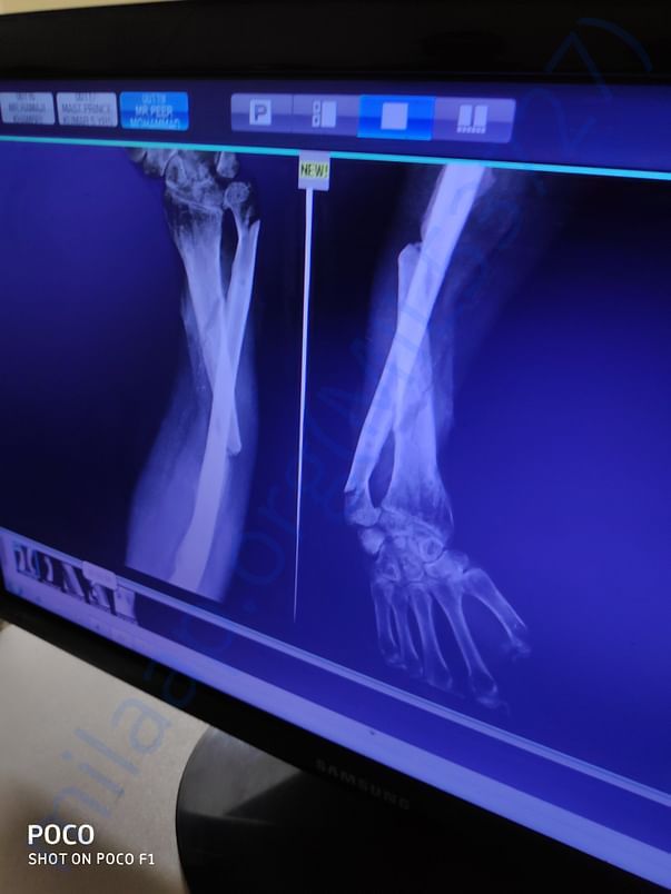 Xray