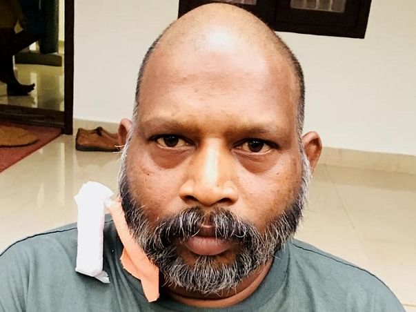 Help Poorna Undergo Kidney Transplant
