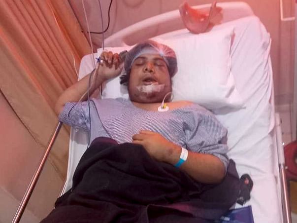 Help Akash Recover from Severe injuries