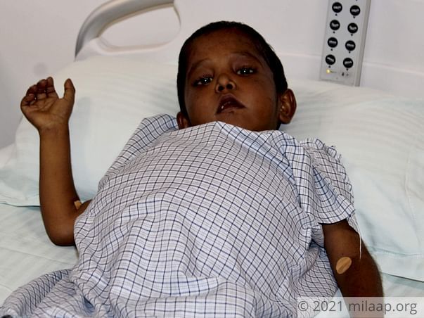 This Boy Screams In Pain Because Of Liver Disease, Needs Urgent Help