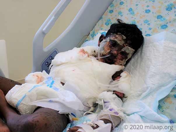 Skin Disease Has Ravaged This Boy's Face And Body, Needs Urgent Help