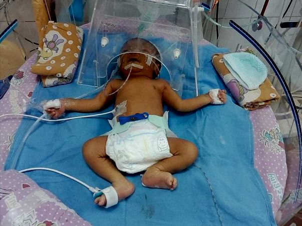 Premature Baby Needs Surgery In 24 Hours To Survive Kidney Damage