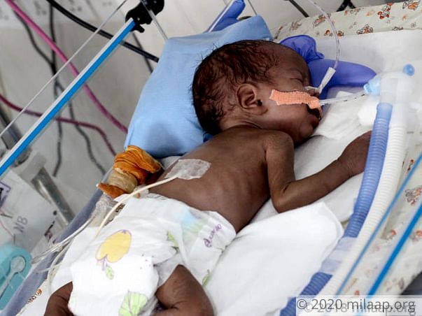 After Losing One Baby, This Couple Now Struggles to Save The Other