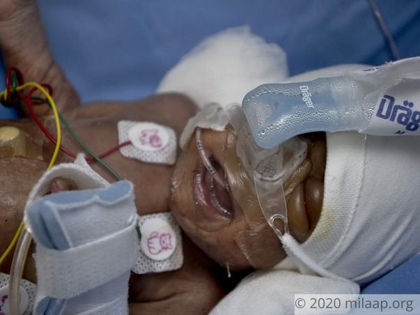 Twins of Soundarya needs your help to survive